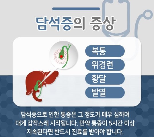 담석증 증상