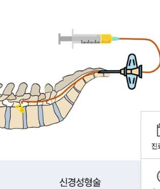 팔저림 원인&amp;#44; 팔저림 어깨 통증&amp;#44; 어깨 통증&amp;#44; 팔저림&amp;#44; 목디스크 증상 팔저림&amp;#44; 왼쪽 팔저림&amp;#44; 오른쪽 팔저림&amp;#44; 목디스크 증상&amp;#44; 목디스크&amp;#44; 양쪽 팔저림