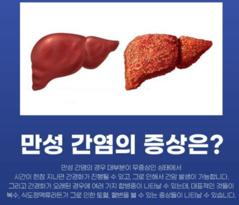  간질환 '간염'에 대한 모든것!!