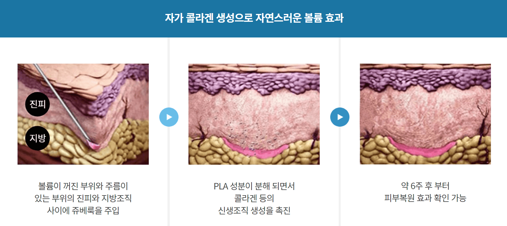 쥬베룩 가격 쥬베룩 볼륨 차이