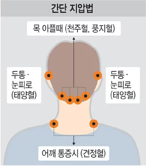 편두통 없애주는 가라앉히는 방법 편두통 영양제 지압 혈자리 완화