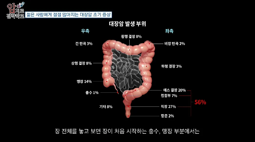 식도암 초기증상