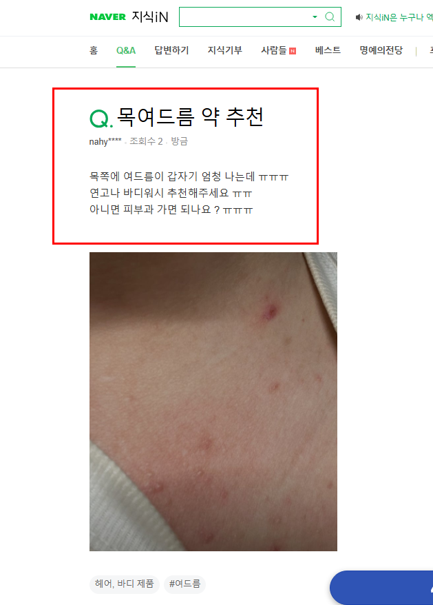 목 여드름 약 추천 질문 지식인