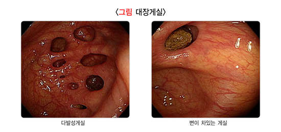 대장게실