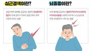 뇌졸중 전조증상