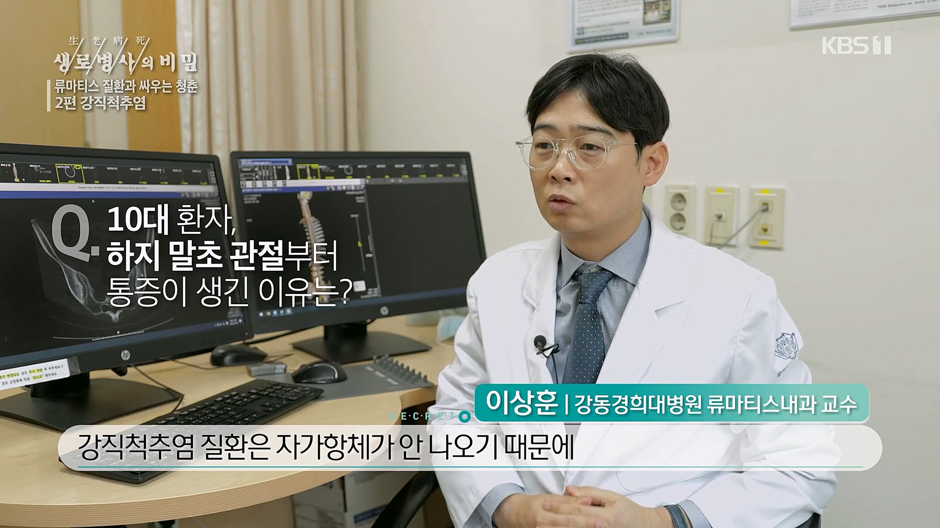 생로병사의 비밀.E861.230322p.H264-F1RST.mp4_20230323_202525.636.jpg