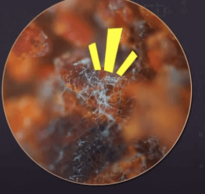 고춧가루에 핀 곰팡이를 현미경으로 확대한 모습