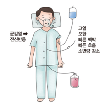 패혈증 증상과 치료방법