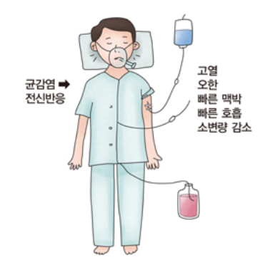 패혈증