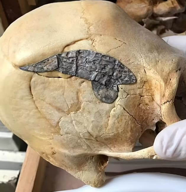 2천년 전 페루인들의 놀라운 수술 기술 VIDEO: 2,000 year-old Peruvian skull may be oldest evidence of SURGERY...