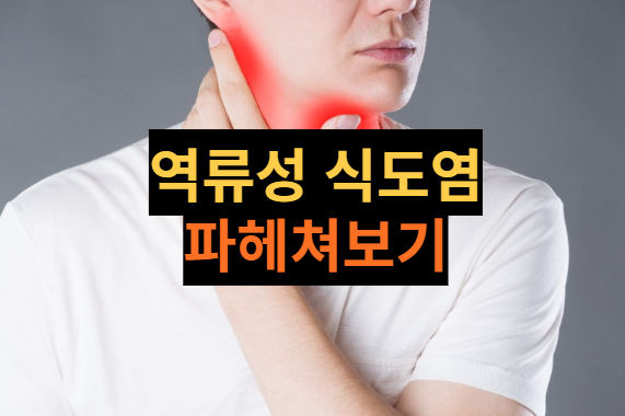 [건강정보] 역류성 식도염, 왜 발생하는 걸까? 원인/증상/예방법에 대해 살펴봐요.