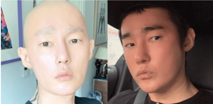허지웅-인스타그램에-올린-투병사진