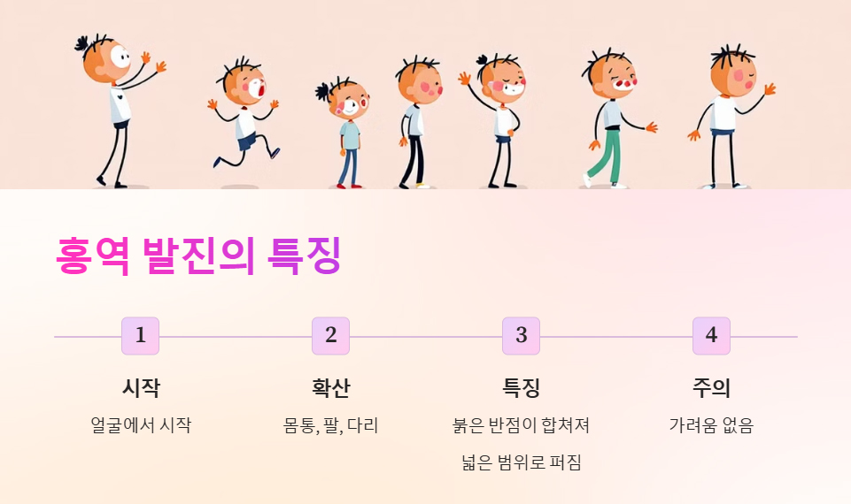 홍역 발진의 특징