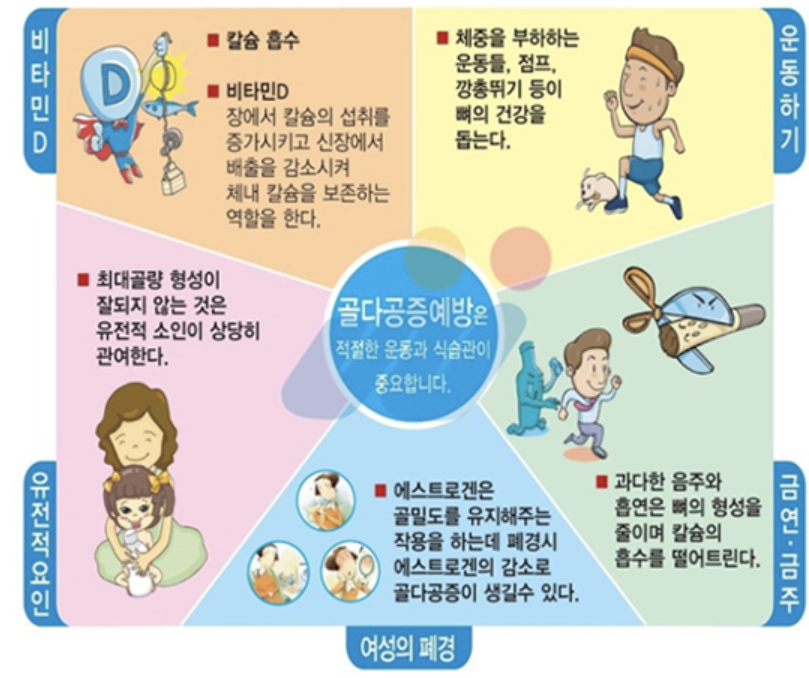 골다공증 치료방법 2