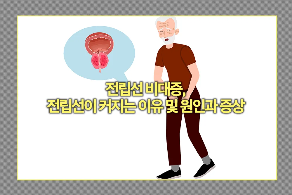 전립선 비대증 전립선이 커지는 이유 원인 증상