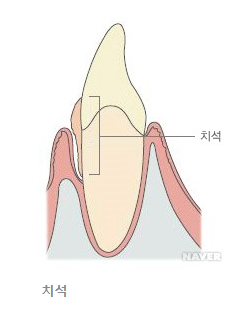 치아