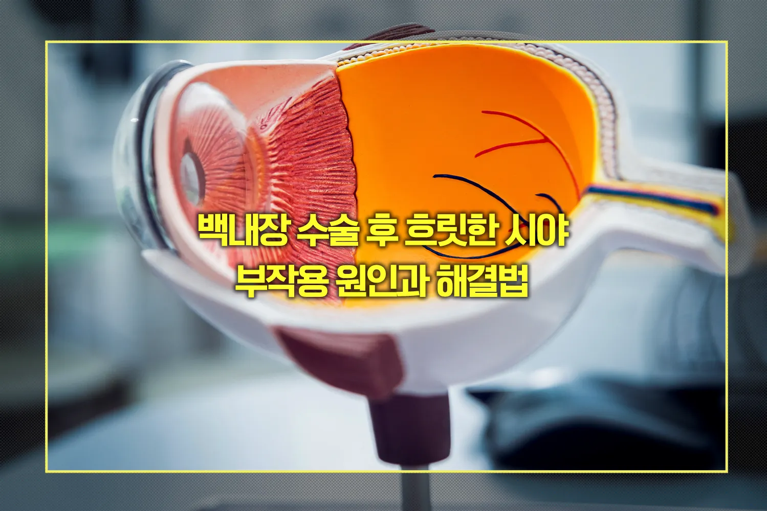 백내장-수술후-흐릿한-시야-부작용해결