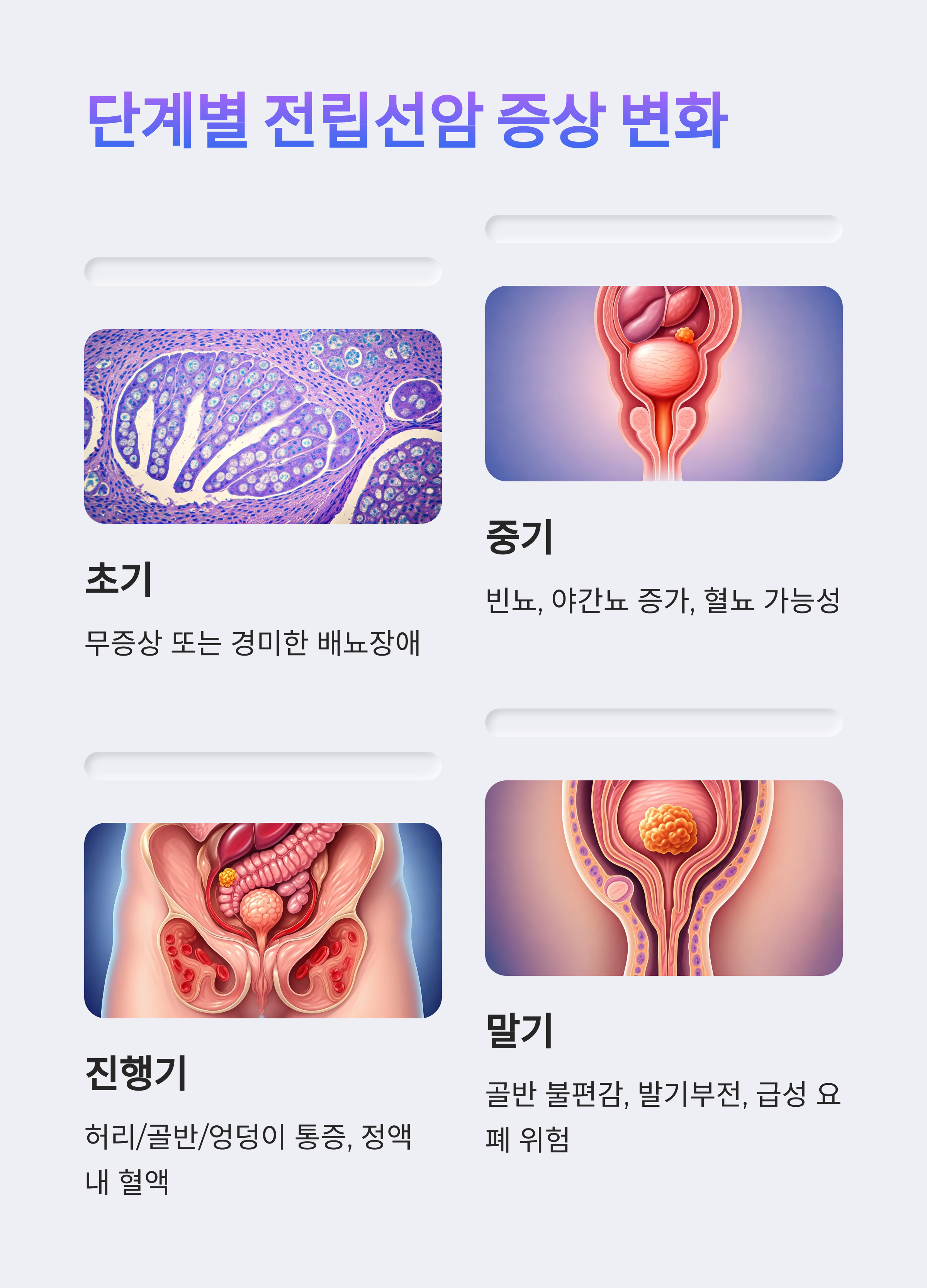 전립선암 단계별 진행과 주요 증상 가이드
