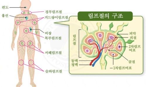 림프종 증상