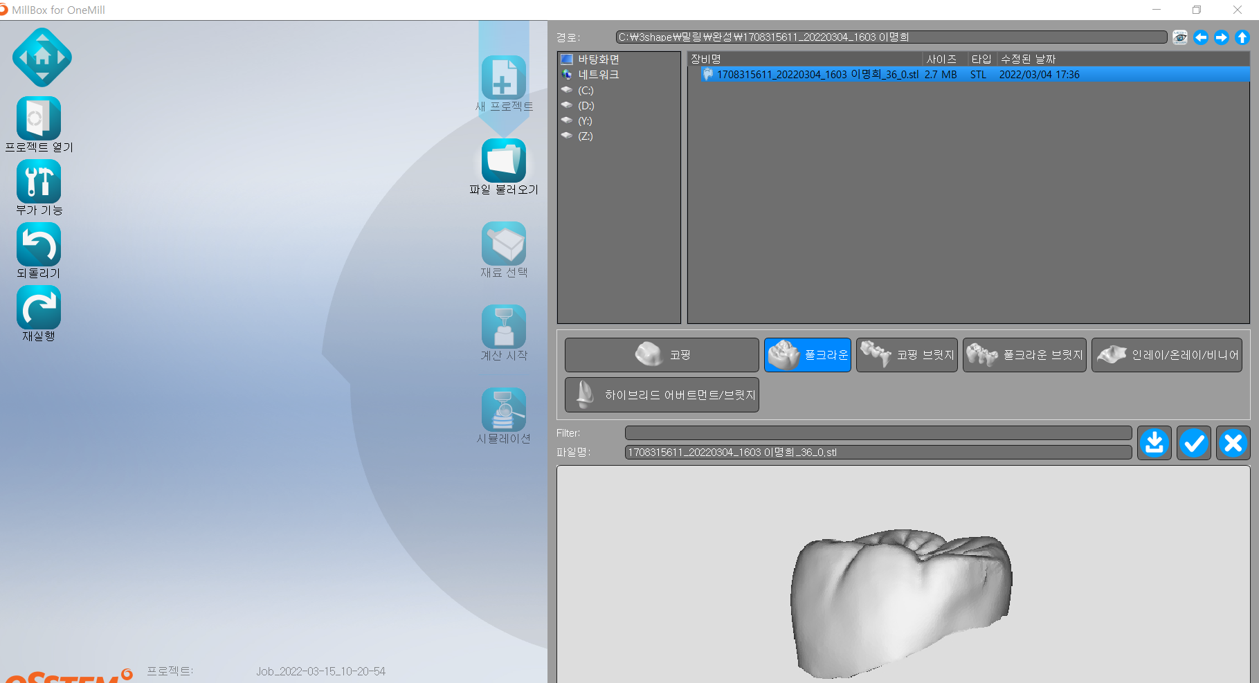 mill box 지르코니아 선택