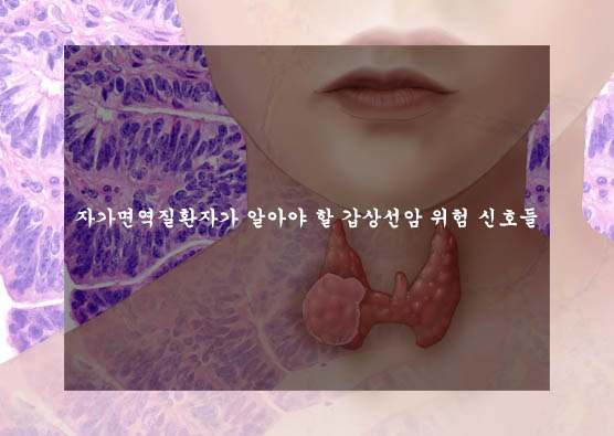  자가면역질환자가 알아야 할 갑상선암 위험 신호들