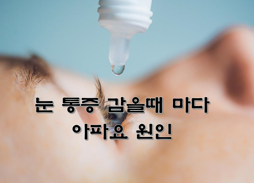  눈 통증 감을때 마다 아파요 원인