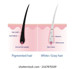 흰머리카락-호르몬-비교-이미지