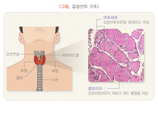  갑상선기능저하증