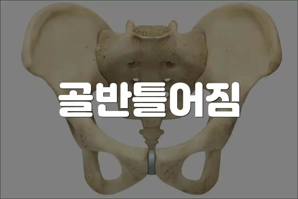 골반 틀어짐 골반 비대칭 원인 증상 치료방법 교정방법 자가진단 임산부 예방법