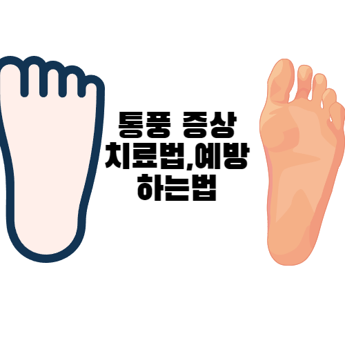 통풍 증상 및 치료법