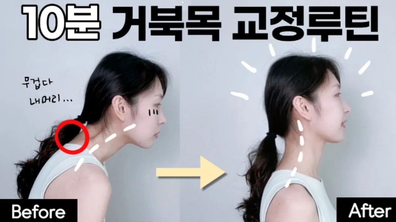 거북목 증상 치료법 스트레칭_7