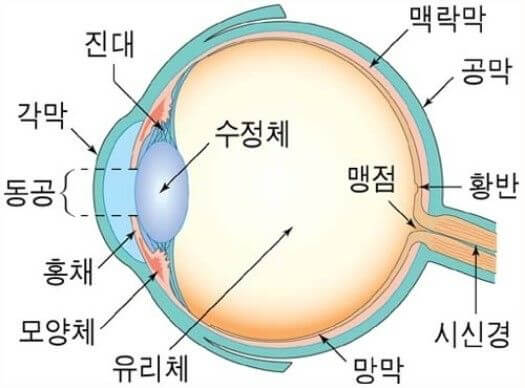 백내장 증상