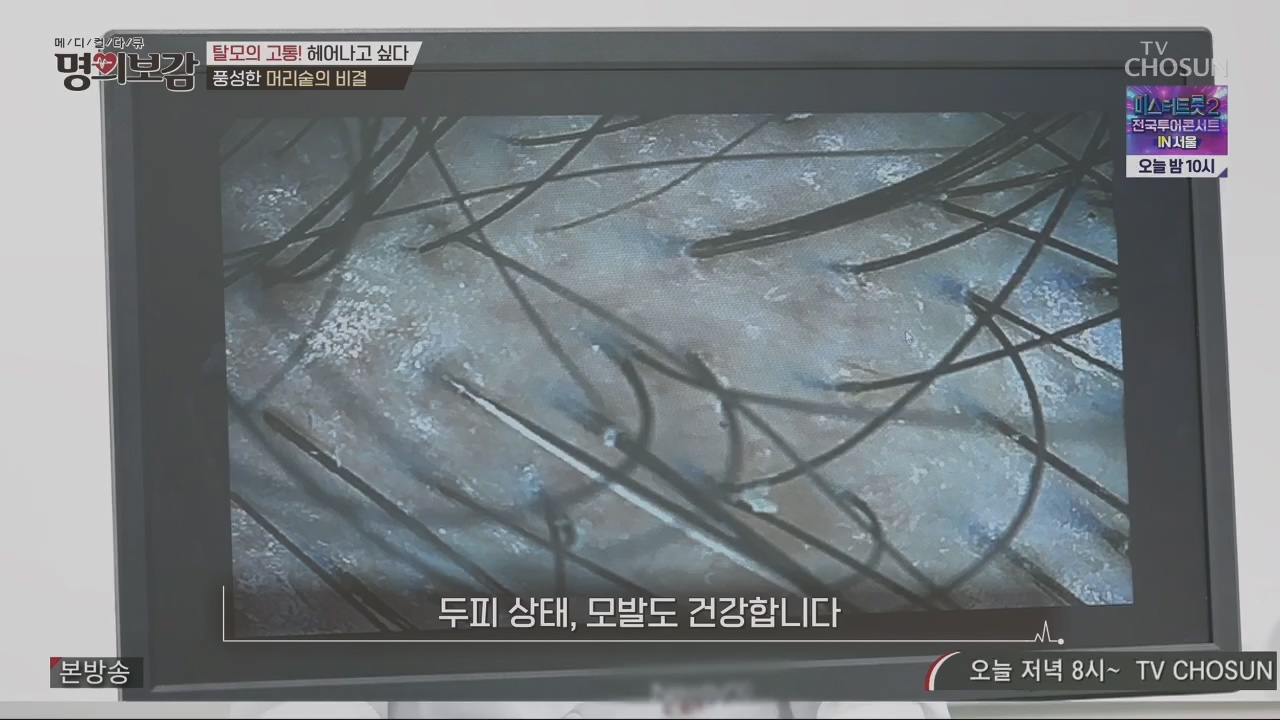 메디컬다큐 명의보감.E03.230527p.H264-F1RST.mp4_20230529_173125.887.jpg