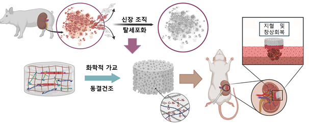신장 출혈과 회복 돕는 지혈 밴드, 해답은 신장에 있었다