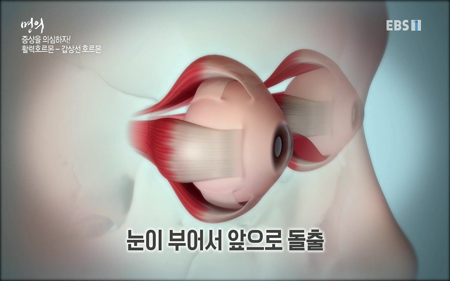 EBS 명의 헬스케어 - TV - 교육의 중심 EBS내 몸을 지배하는 7가지 호르몬 2부, 증상을 의심하자!.mp4_20220711_200205.789.jpg