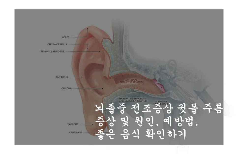  뇌졸중 전조증상 귓볼 주름 증상 및 원인, 예방법, 좋은 음식 확인하기