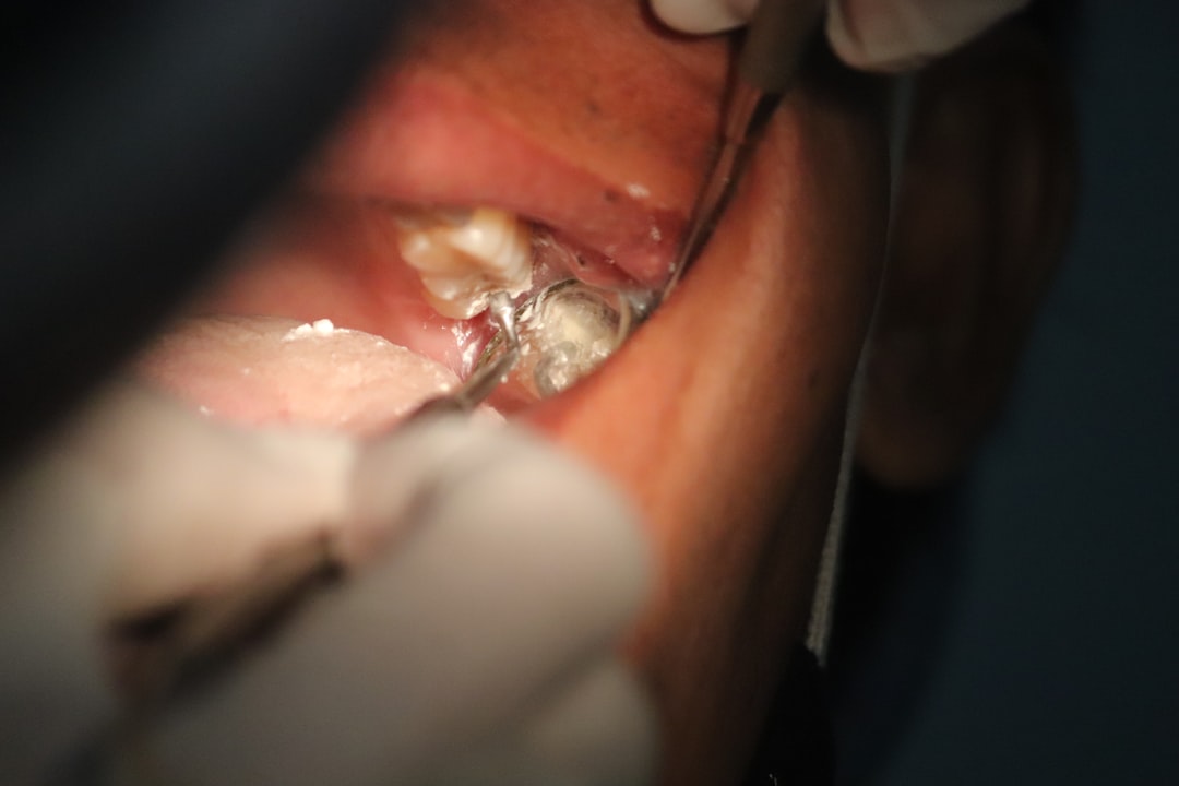 Procedure