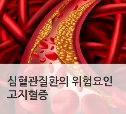 심혈관질환의 위험요인 고지혈증 (출처 : 건강IN 매거진 2018년 3월호)