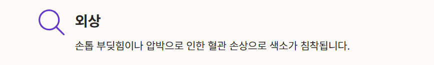 검은 세로줄의 주요 원인 1