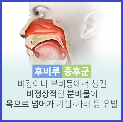 후비루 증상 후비루 치료