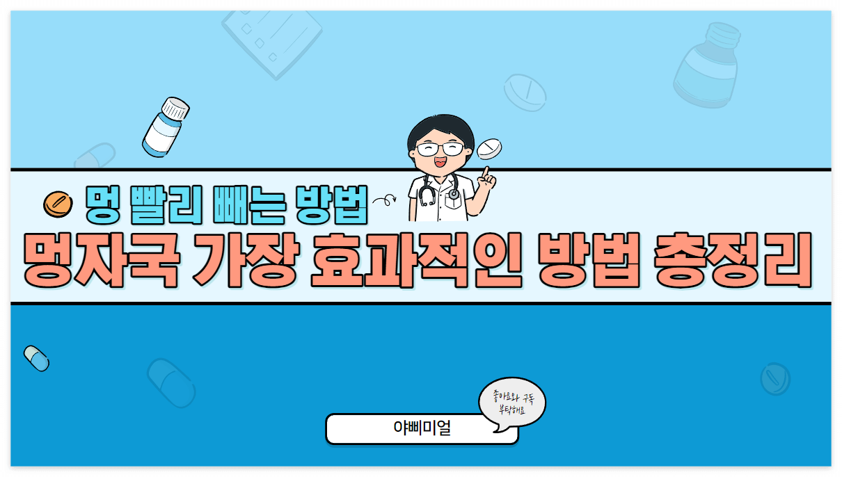  멍 빨리 빼는 법 - 멍자국 가장 효과적인 방법 총정리