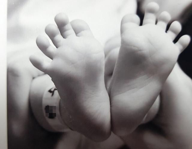 구미사건 '구미 여아 사건' 발찌 3