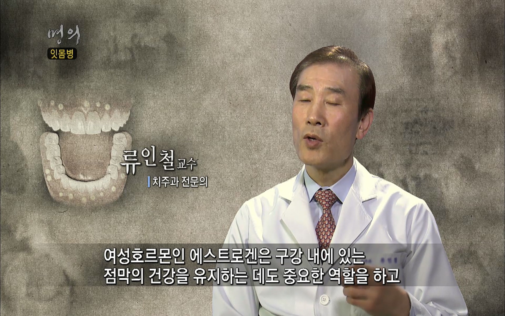 EBS 명의 헬스케어 - TV - 교육의 중심 EBS2015년 1월 16일 (금) 밤 9시 50분, EBS1.mp4_20220505_150113.960.jpg