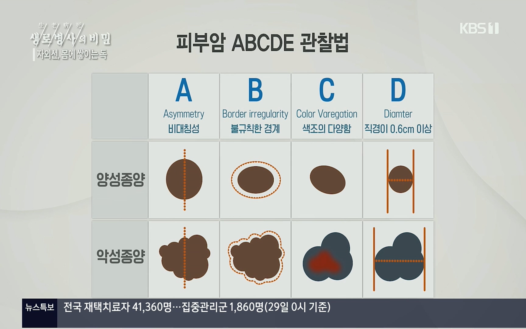 생로병사의 비밀.E824.220629p.H264-F1RST.mp4_20220630_204334.416.jpg