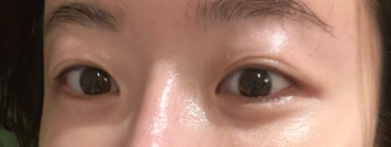  아이 울쎄라, 100% 만족할 수 있으려면 ㅇㅇ을 확인하세요!