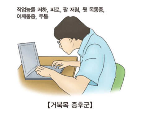  카이로넥 거북목 교정기 효과와 실제 후기정리