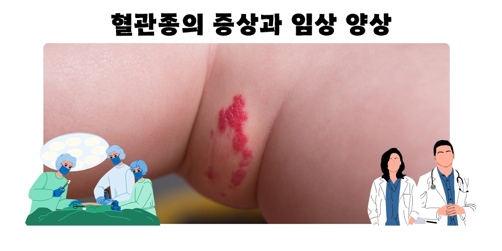 혈관종8
