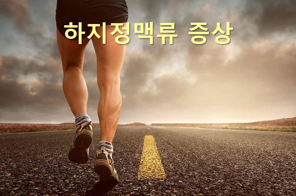  하지정맥류 좋은 운동과 하지정맥류 병원