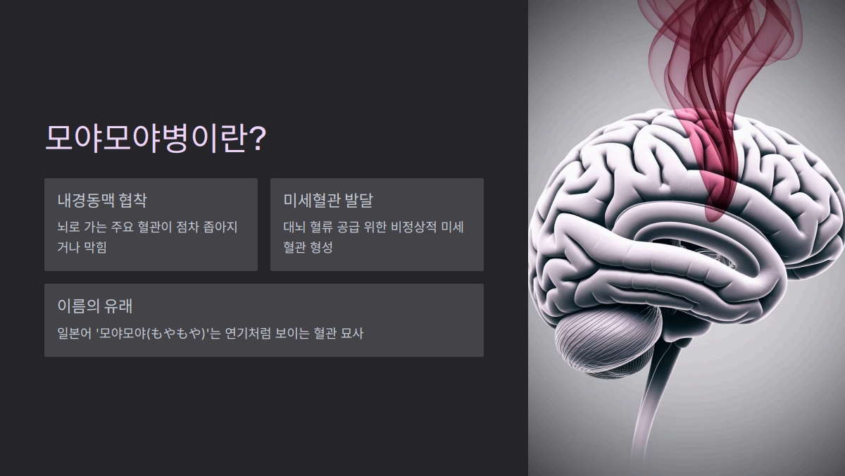 모야모야병 수명
