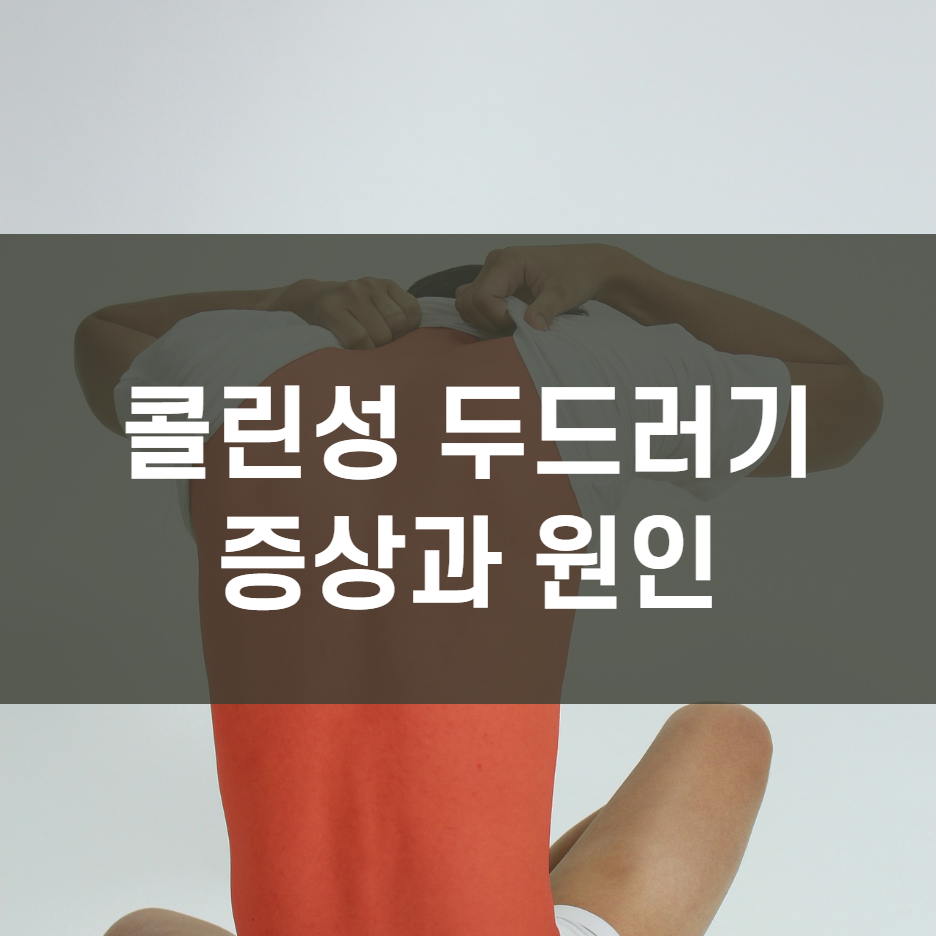  콜린성 두드러기의 원인과 증상 (경험담)
